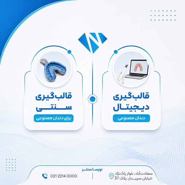قالب گیری سنتی و دیجیتال برای دندان مصنوعی