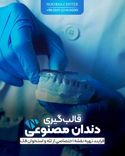 قالب گیری دندان مصنوعی چگونه انجام می شود؟