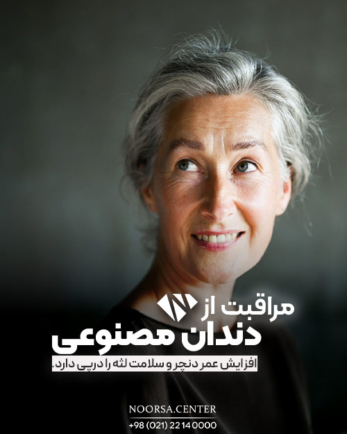 مراقبت از دست دندان