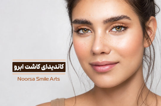 کاندیدا و شرایط مناسب کاشت ابرو