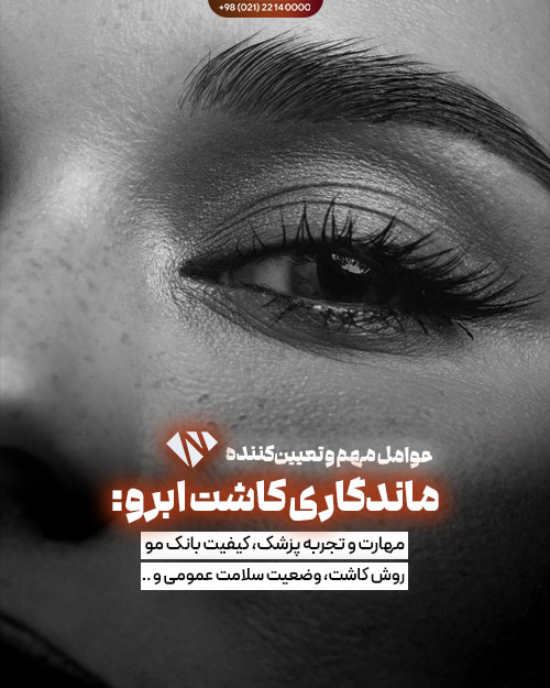 عوامل موثر بر ماندگاری کاشت ابرو