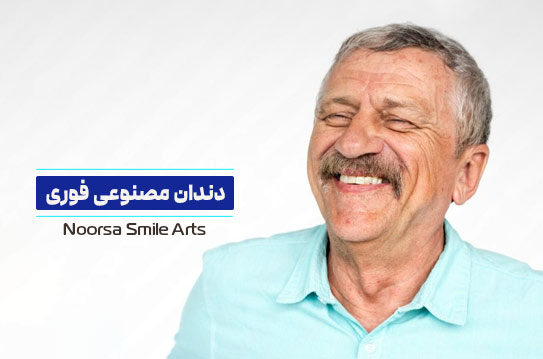 دندان مصنوعی فوری یا موقت