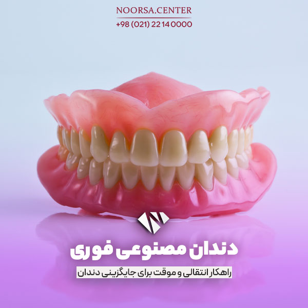 دندان مصنوعی فوری برای جاگزینی موقت دندان های از دست رفته