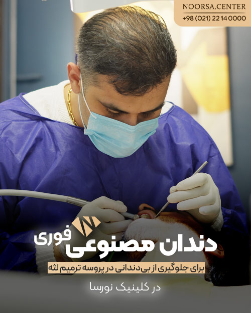 دندان مصنوعی فوری در کلینیک نورسا