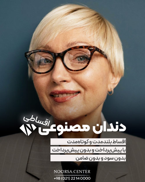 شرایط اقساط دندان مصنوعی در کلینیک نورسا