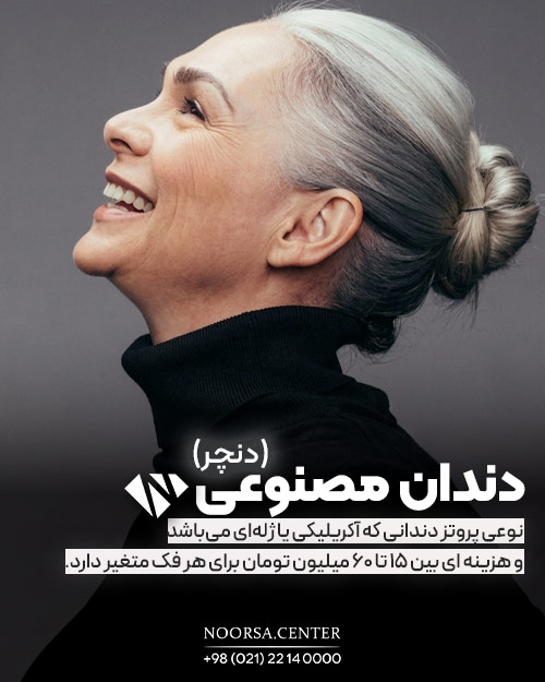 دندان مصنوعی و هزینه آن
