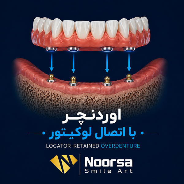 اوردنچر لوکیتور