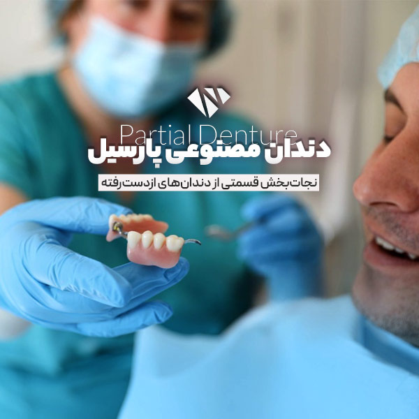 دندان مصنوعی پارسیل چیست