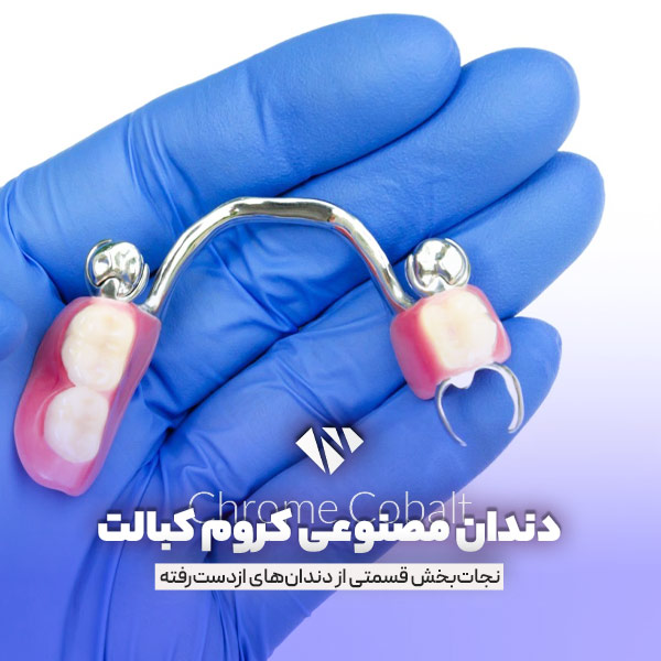 دندان مصنوعی کروم کبالت (پروتز کروم کبالت)