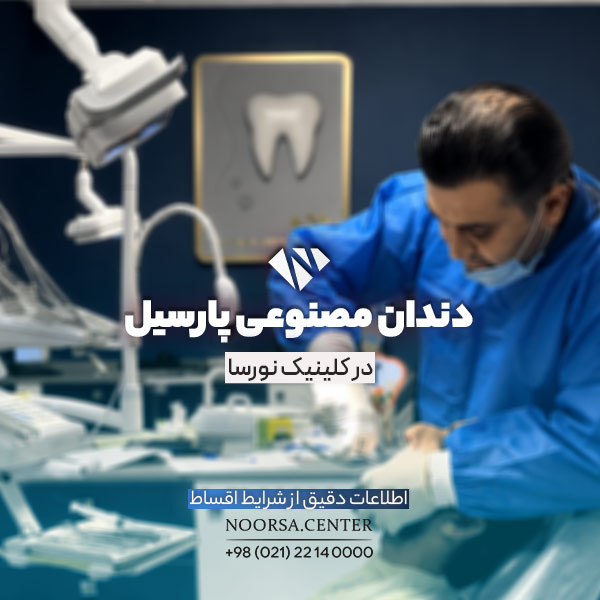 پروتز پارسیل اقساطی در کلینیک نورسا