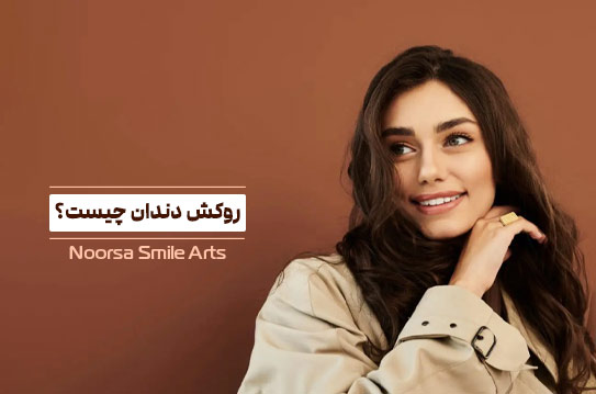 روکش دندان چیست؟