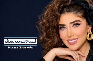 هزینه کامپوزیت لیرینگ دندان