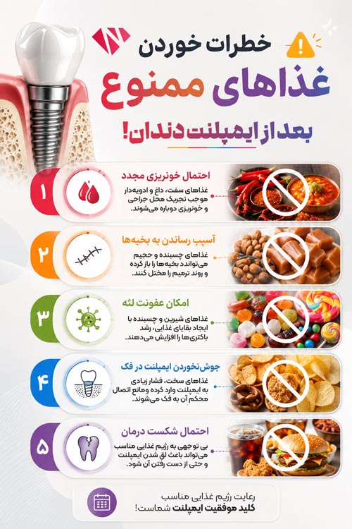 خطرات خوردن خوراکی های ممنوع بعد از ایمپلنت دندان
