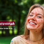 رقیق کننده خون و ایمپلنت دندان
