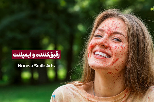 رقیق کننده خون و ایمپلنت دندان