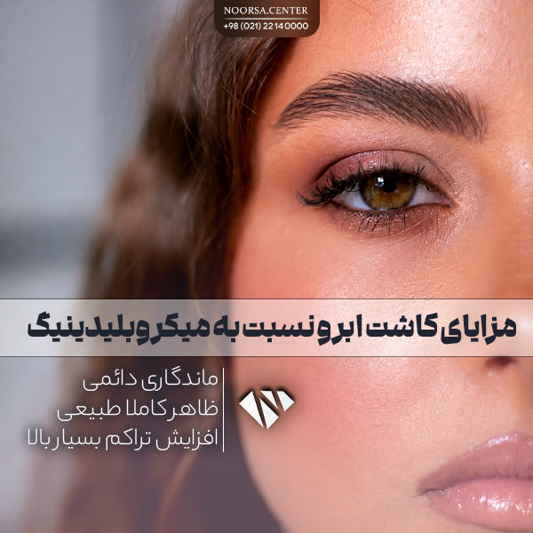 مزایای کاشت ابرو نسبت به میکروبلیدینگ