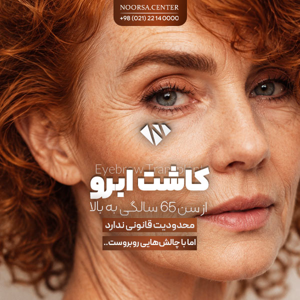 کاشت ابرو بعد از 65 سالگی