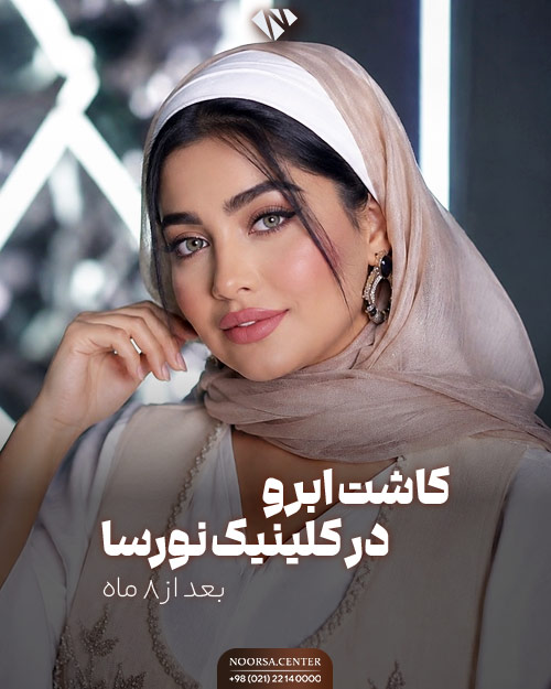 کاشت ابرو کلینیک نورسا