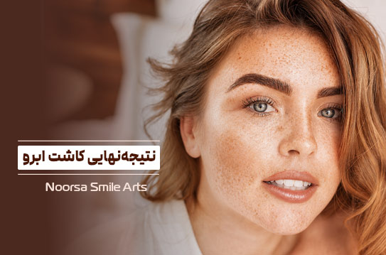 مشخص شدن نتیجه کاشت ابرو