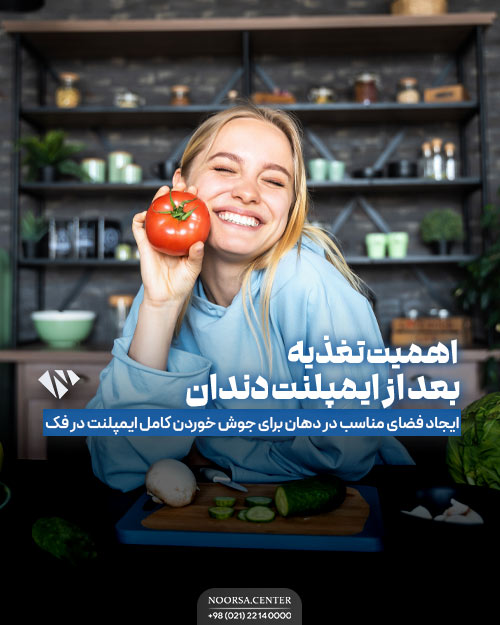 اهمیت تغذیه بعد از ایمپلنت دندان