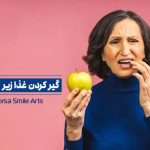 مشکل گیر کردن غذا زیر اوردنچر