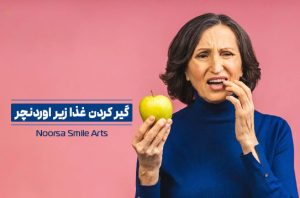 مشکل گیر کردن غذا زیر اوردنچر