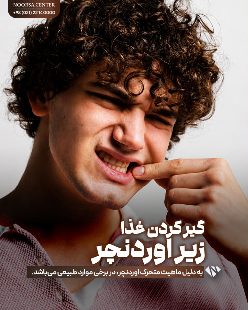 گیر کردن غذا زیر اوردنچر