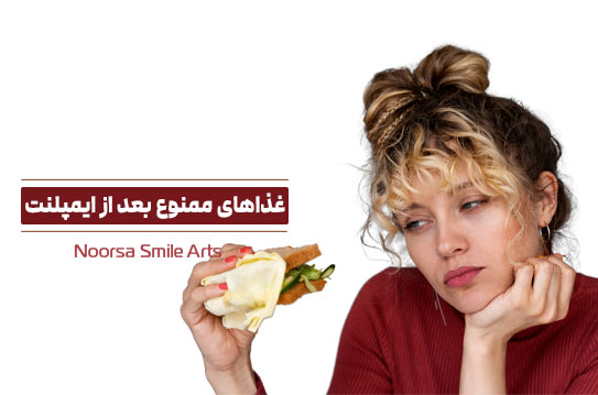 غذا و خوراکی های ممنوع بعد از ایمپلنت دندان
