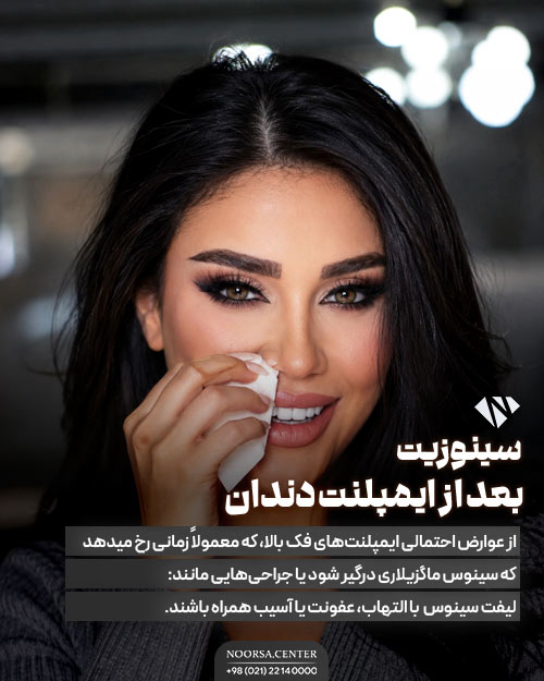 سینوزیت بعد از ایمپلنت دندان