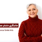 طول عمر دندان مصنوعی چقدر است