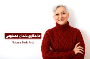 طول عمر دندان مصنوعی چقدر است