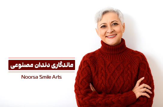طول عمر دندان مصنوعی چقدر است