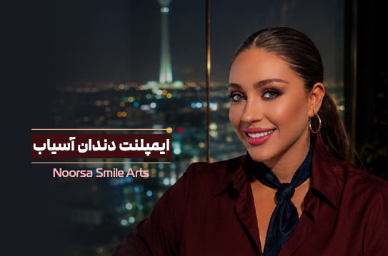 ایمپلنت دندان آسیاب