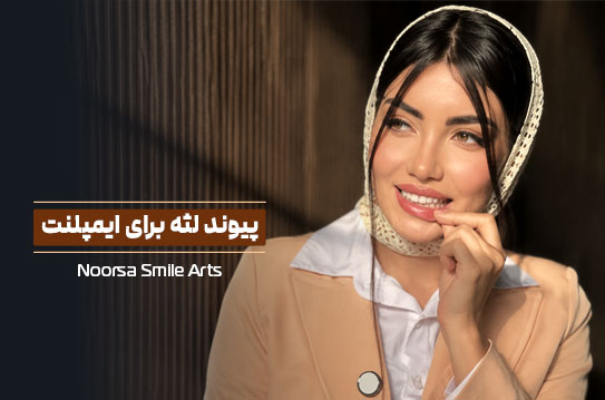 پیوند لثه قبل از ایمپلنت دندان