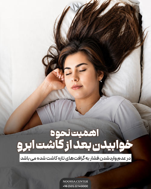 اهمیت خوابیدن صحیح بعد از کاشت ابرو