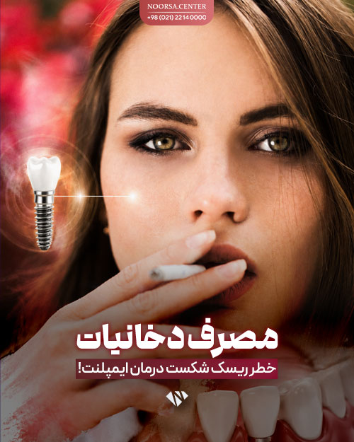 مصرف دخانیات، خطر ریسک شکست درمان ایمپلنت دندان
